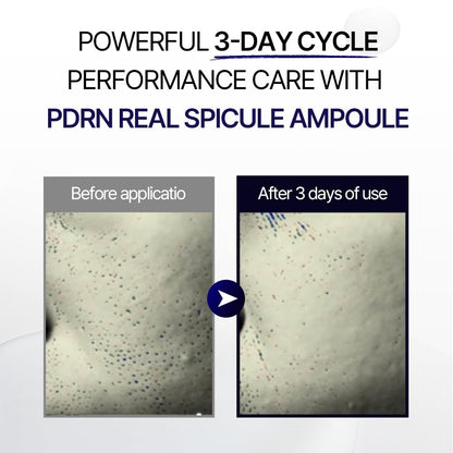 Ultimate Rejuvenation Spicule Ampoule – Korean Skincare PDRN Serum for Anti-Wrinkle, Pore Care & Skin Renewal – Dermatologist-Tested, Brightening Ampoule for Radiant, Smooth Skin – 50ml